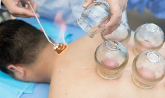 Κάνουν οι βεντούζες τελικά αυτό που υπόσχονται; Τι λένε οι ειδικοί;